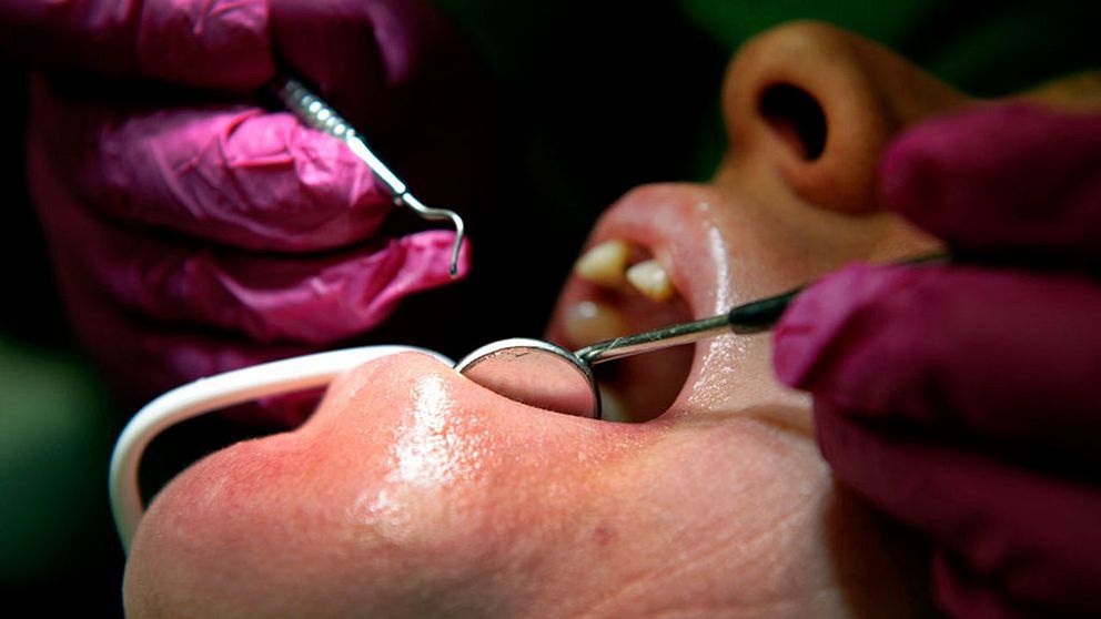 Vill kontrollera cancer – hos tandläkaren
