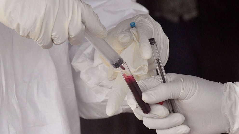 Blod testas för Ebola i Liberia, 2015. Arkivbild.