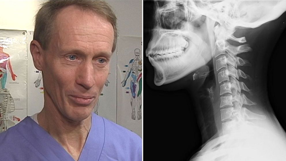 läkaren och smärtforskaren Bo Christer Bertilson samt röntgenbild av en nacke.