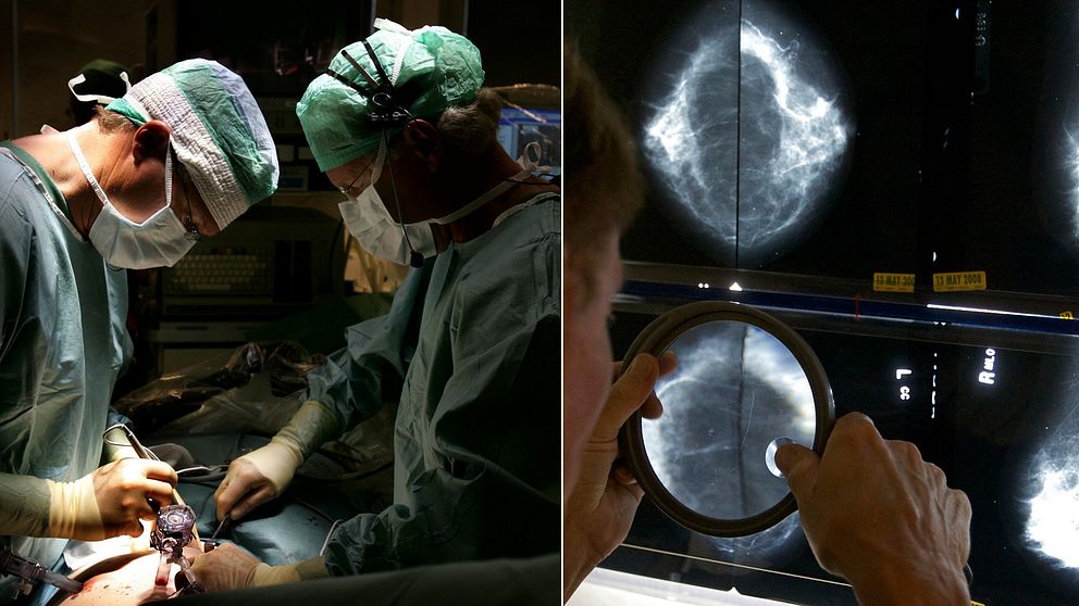 Bilder på operation och mammografi. Genrebilder.