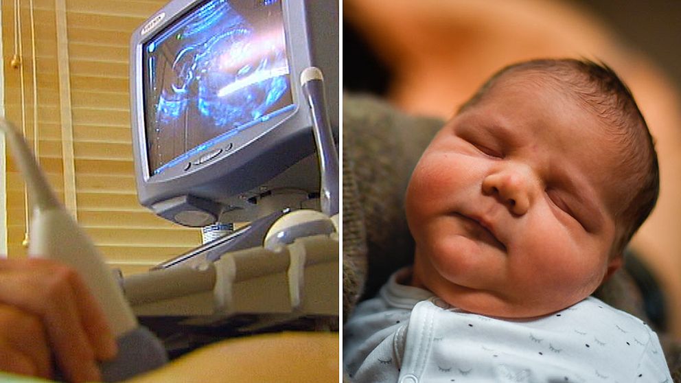 förlossning ultraljud nyfödd bebis
