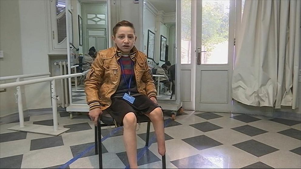 Abdul Hamid, 11 år, skadades av en granat och tvingades amputera benet.