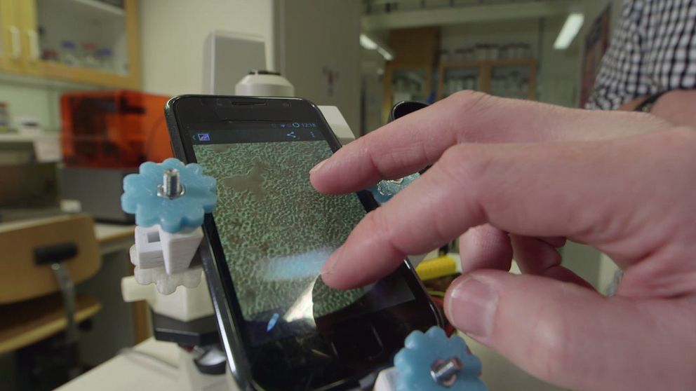 En bild när man ser Johan Kreugers hand som zoomar in på cellerna på sin mobiltelefonen som är fäst på mikroskopet med hjälp av en 3d-utskriven hållare.
