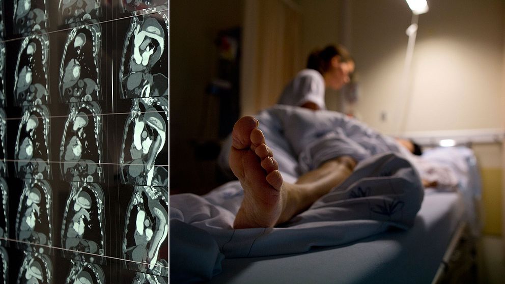 Bild på person i sjukhussäng till höger och bild på röntgenbild till vänster.