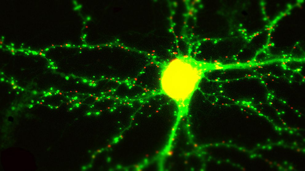 Synapserna visas som ljusa fläckar och då hjärnan bearbetar ny information förändras de ljusa fläckarna. Det är en visuell indikering på hur strukturer i hjärnan har ändrats av de nya uppgifterna.