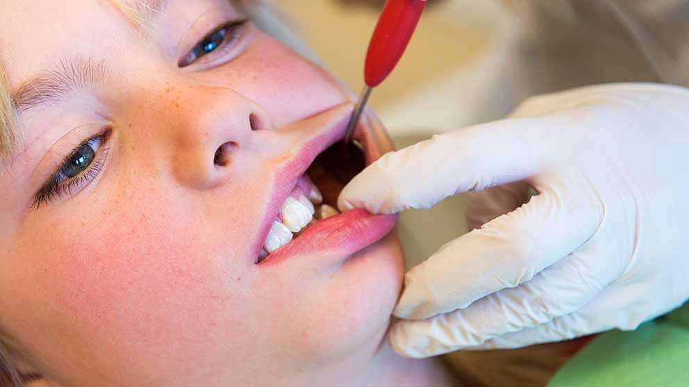 Barn som har missfärgningar eller tandskador kommer inte att kunna bleka tänderna hos tandläkaren, enligt ett EU-direktiv.