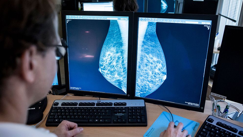 En läkare tittar på bröströntgenbilder, mammografibilder.