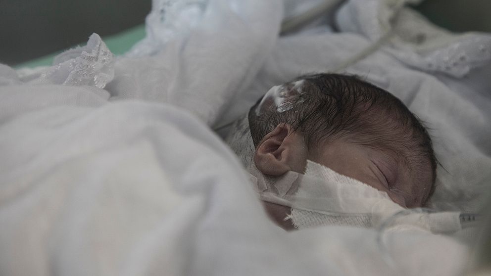 En förtidigt född bebis som kämpar för sitt liv.