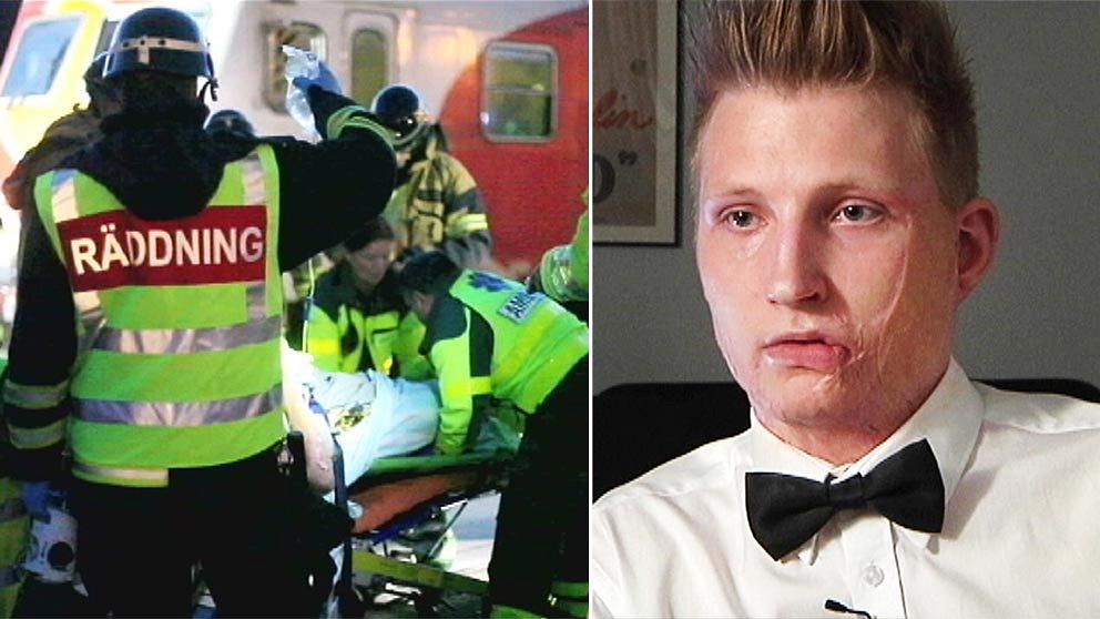 För ett och ett halvt år sedan brännskadades Axel Schylström allvarligt efter att ha klättrat på ett tåg. Idag föreläser han sin väg tillbaka.