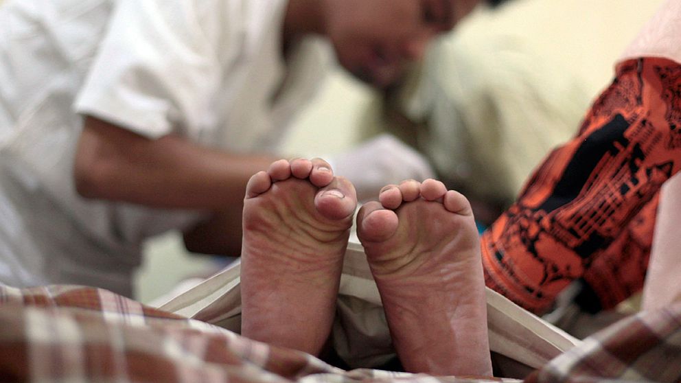 En pojke i Jakarta, Indonesien, kniper med tårna i smärta under en omskärelse.