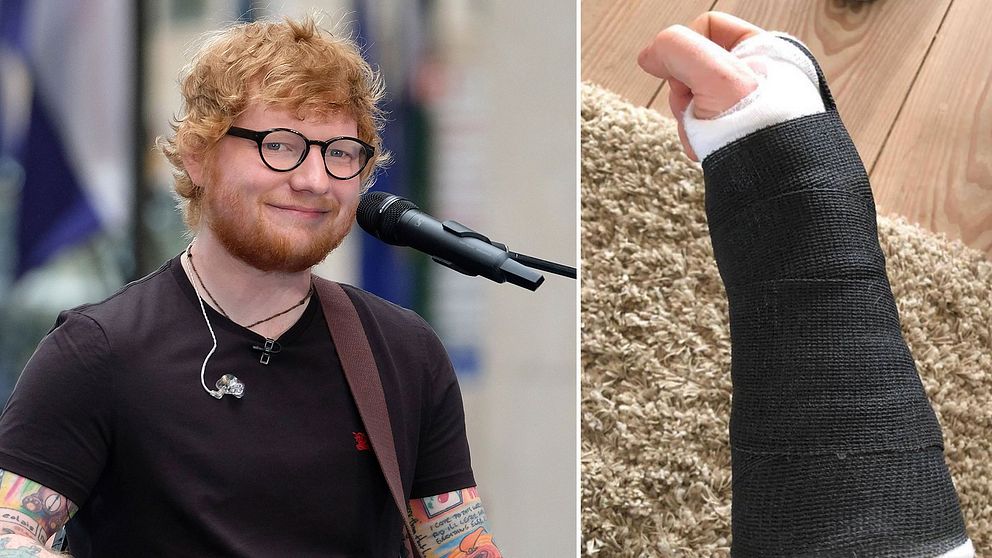 Brittiska sångaren Ed Sheeran ställer in spelningar då han skadat armarna.