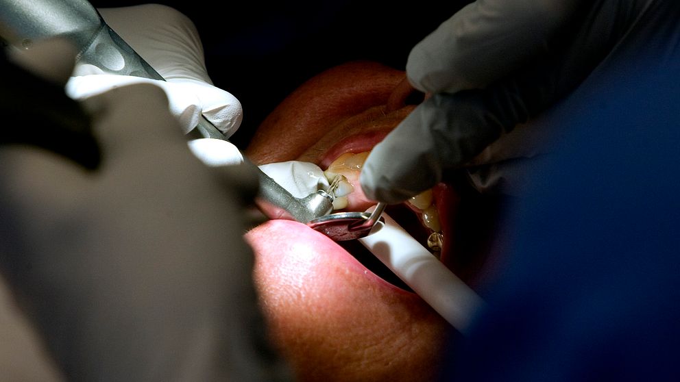 En person får behandling hos en tandläkare.