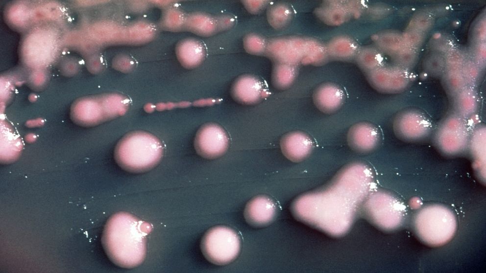 Motståndskraftiga bakterier kan orsaka svåra och kroniska infektioner.