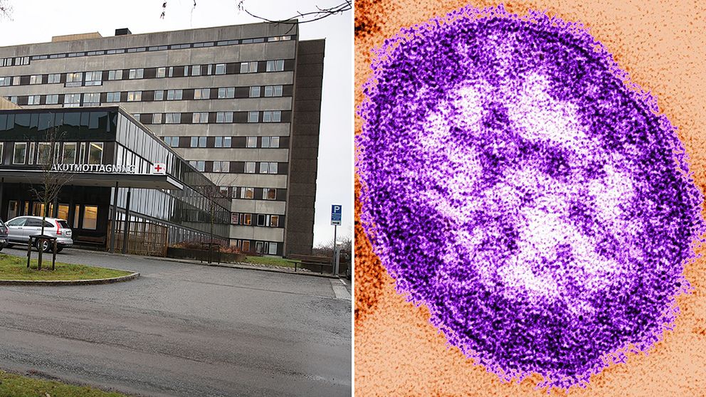 mässlingvirus och Östra sjukhuset i Göteborg