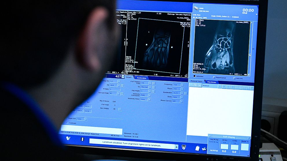 Mohassad Al Atia, röntgensjuksköterska, studerar bilderna från magnetkameran på sin skärm.