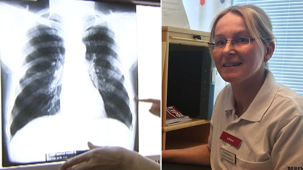 röntgenbild på  lungor, samt porträttbild av en kvinna