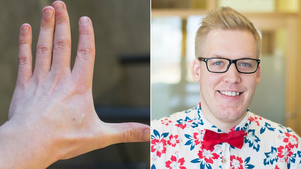 30-åriga Freddy Grip från Stockholm har implanterat två mikrochip, en i varje hand, sedan förra sommaren.