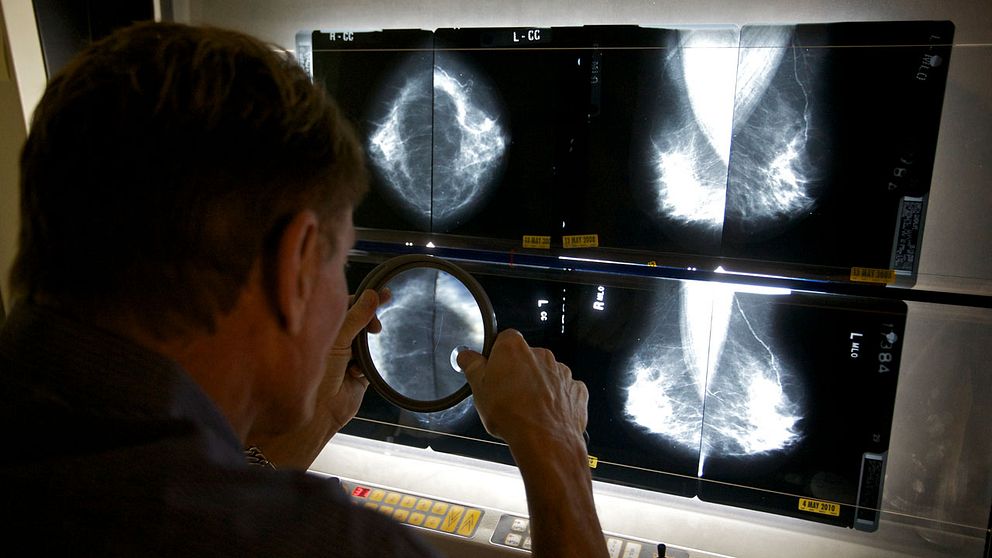 röntgenbilder på bröst