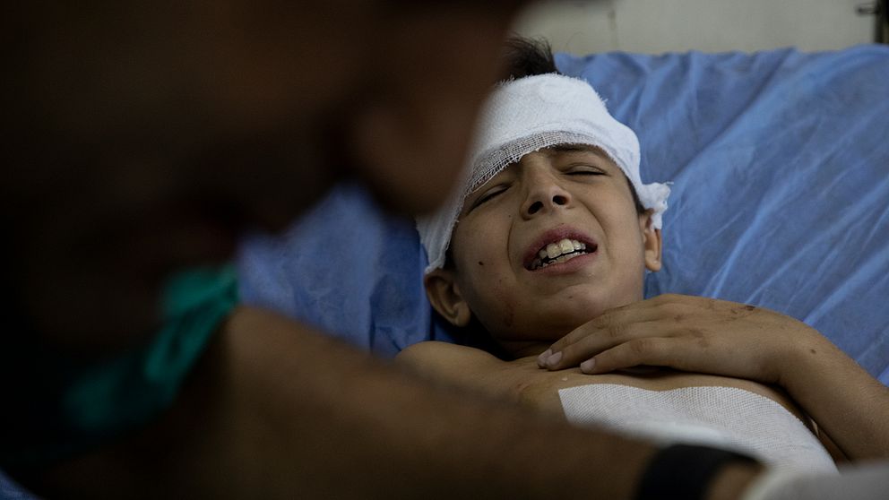 Ett skadar barn i Syrien grinar illa när han undersöks av läkare.