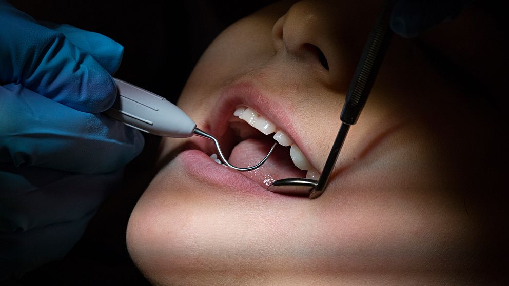 En person får sina tänder undersökta av en tandläkare