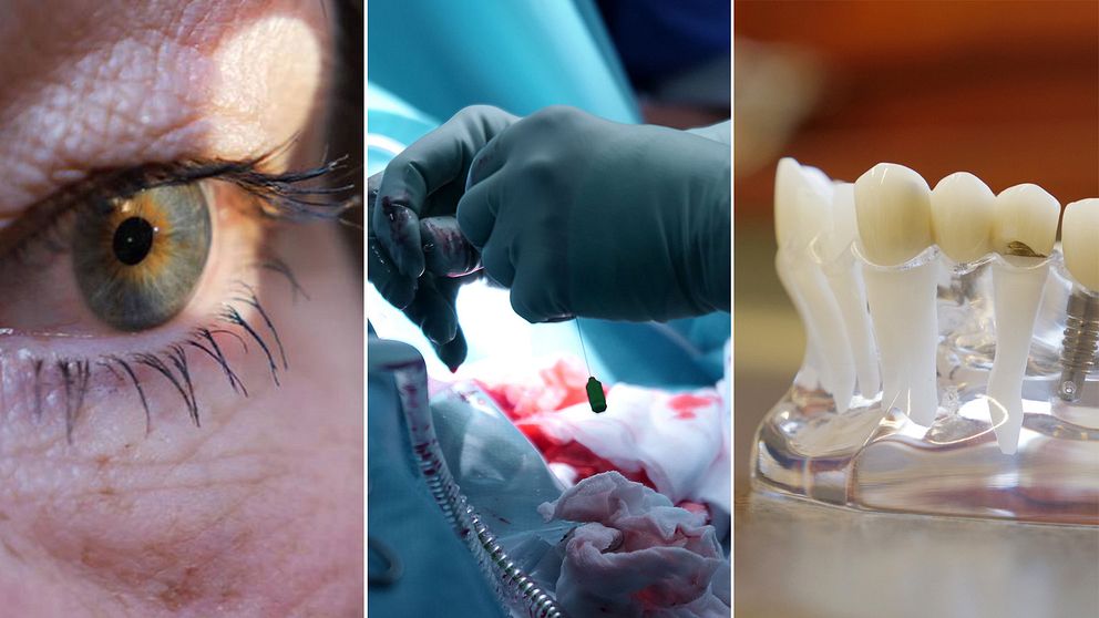 Ett öga, en operation och tandimplantat