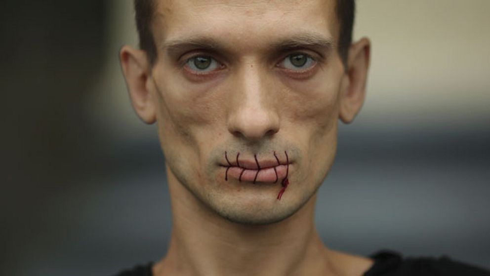 Ryska performanceartisten Petr Pavlensky har sytt ihop sina läppar i protest mot att de Putin-kritiska aktivisterna i Pussy Riot fortfarande sitter i häktet.