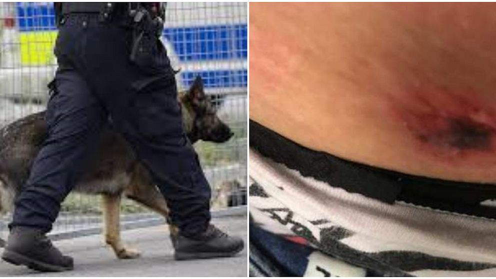 polishund och skador efter bettet