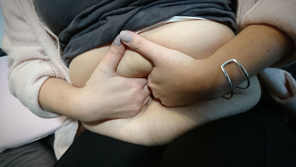 En kvinna trycker in nävarna i magen för att visa på magmuskeldelning efter graviditet.