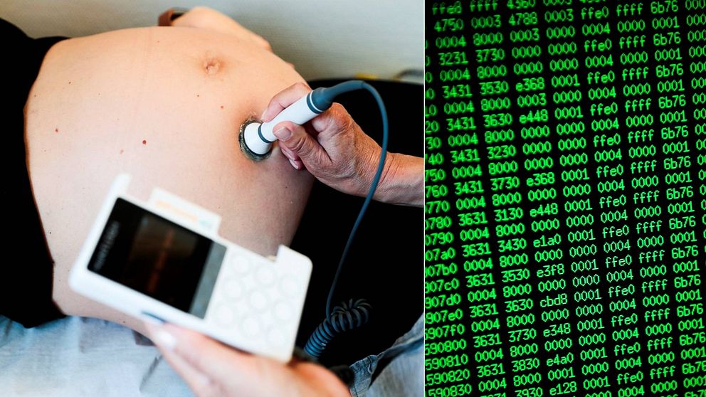 barnmorska tar ultraljud på en gravidmage samt en bild på en dataskärm med gröna siffror