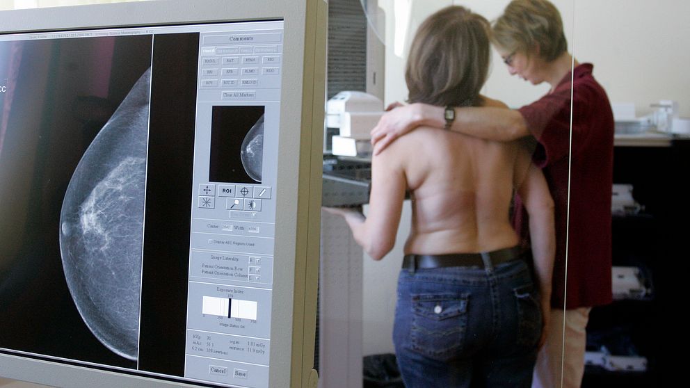 En kvinna screenas för bröstcancer, en av de vanligaste cancerformerna bland kvinnor. Trots det får många skånska kvinnor vänta för länge innan de får behandling.