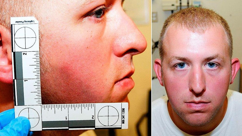 I samband med beslutet har bilder på polismannen Darren Wilson från kvällen då dödsskjutningen skedde publicerats. På bilderna syns blåmärken i Wilsons ansikte.