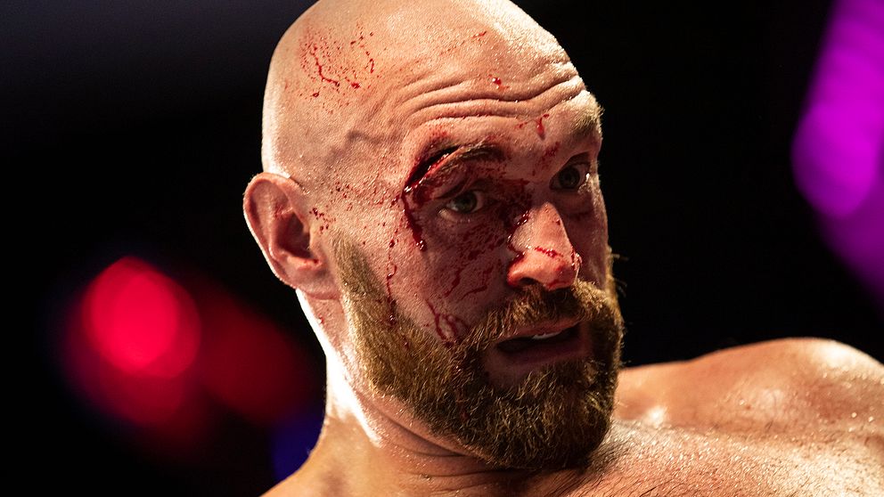 Otto Wallin slog upp ett stort sår ovanför Tyson Furys högra öga i september.