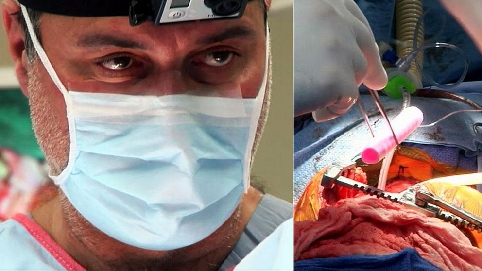 Världsberömde kirurgen Paolo Macchiarini har gjort tre experimentella transplantationer utan etiskt tillstånd.