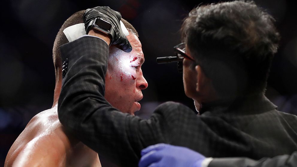 En läkare kollar närmare på UFC-stjärnan Nate Diaz under en match i november förra året.