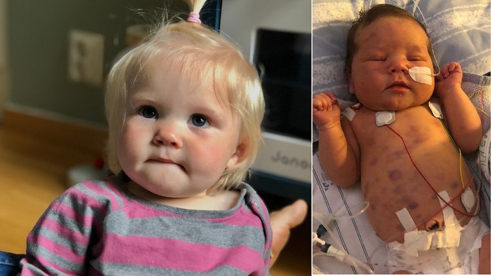 Till vänster en liten flicka med tofs i håret. Till höger, ett nyfött barn med sladdar fast i kroppen.