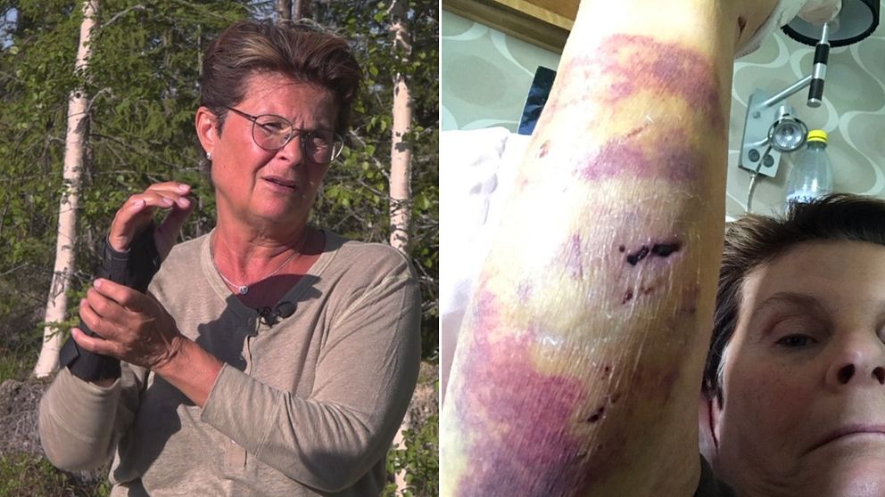 Anitha Strömberg står utomhus och visar med sina händer hur hundattacken till gick till. I en annan bild, till höger, visar hon upp en sårskadad arm efter hundattacken.