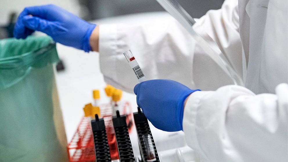 Blodprover görs klara för att analyseras avseende covid-19 antikroppar i ett laboratorium.