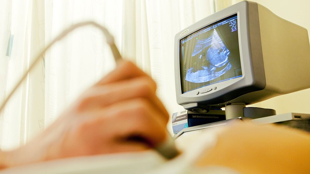 En hand som utför ultraljud på en gravidmage syns i förgrunden, i bakgrunden står en monitor i sjukhusmiljö.