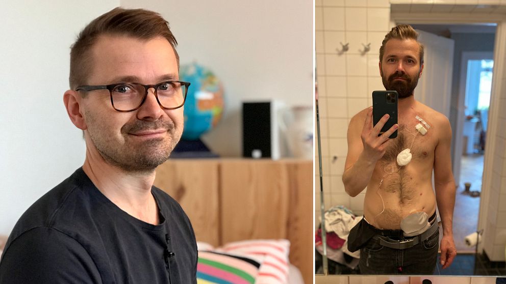 Tarmcancer, Mattias Johansson fotograferade sig själv under behandlingstiden