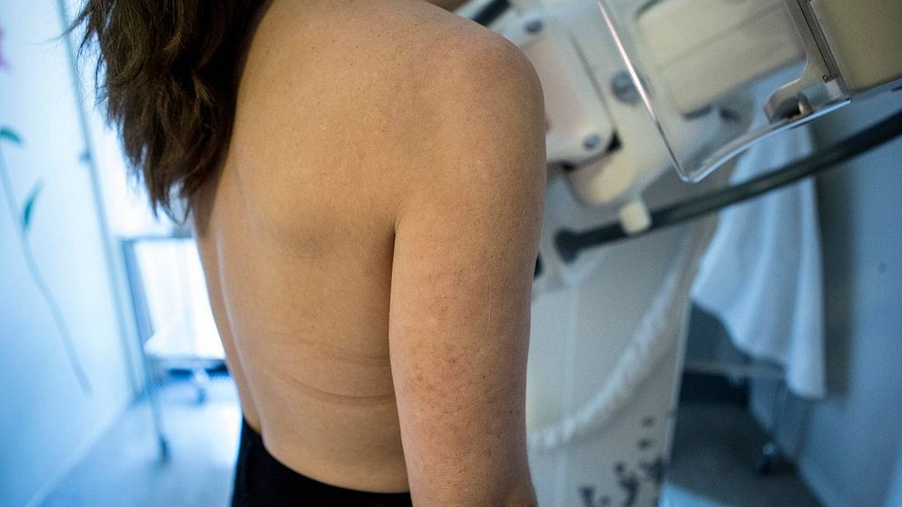 Kvinna står vid en mammografi apparat för att få mammografi