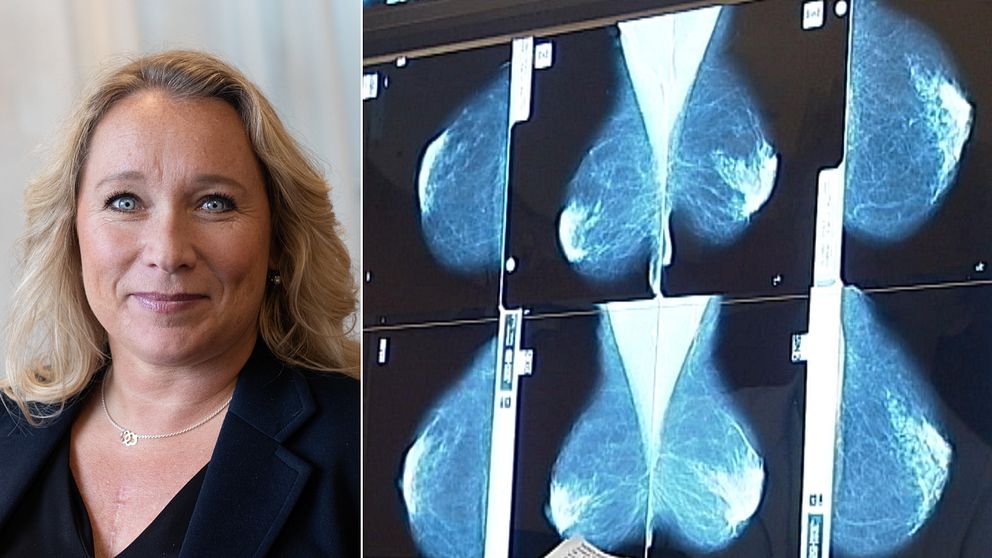 Det är ett collage där Helen Häggström syns till vänster, hon är blåögd och har blont hår. Bilden på henne är ett porträtt. Till höger syns flera röntgenbilder på bröst, från mammografi. Brösten syns i blått och bakgrunden är svart.