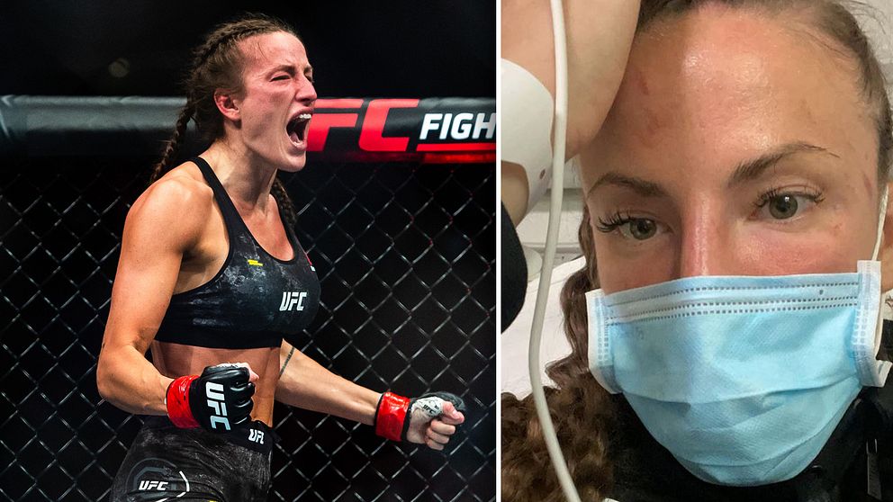 ”Jag tror att jag har gått runt med hjärnskakningssymptom under nästan två år”, säger MMA-fajtern Bea Malecki till SVT.