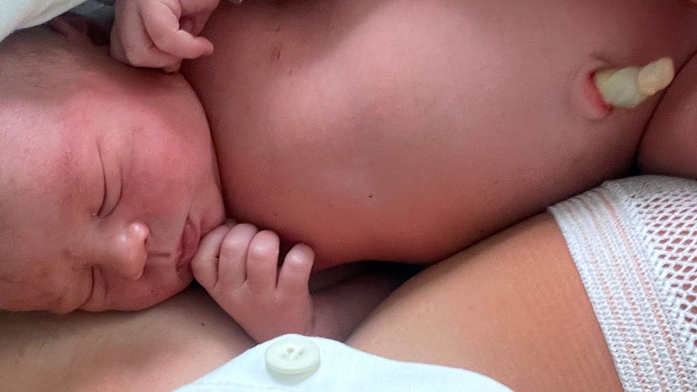 Bild på bebis med navelsträng