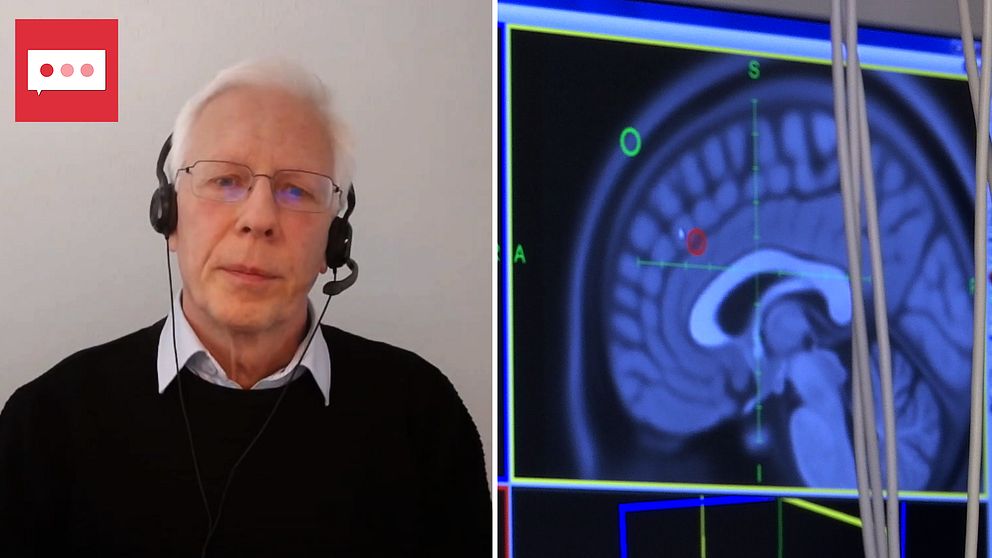 Tvådelad bild: Gunnar Hägglund, professor i barnortopedi under ett videosamtal, samt en hjärna sedd i en skärm till en magnetröntgen.