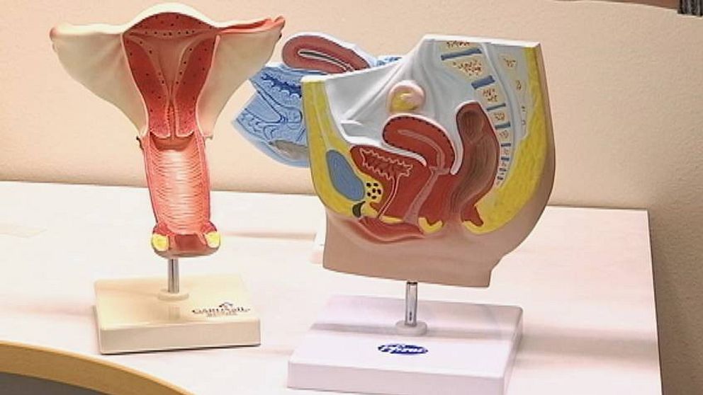Endometrios är en ärftlig sjukdom.