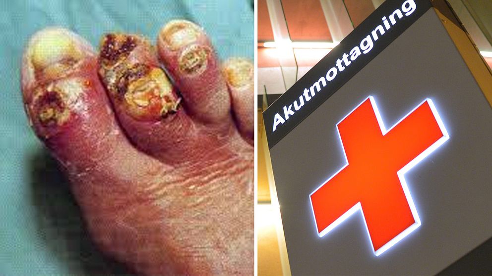 Läkaren hade 47 försök på sig att upptäcka vad som var fel med mannens fot. Men han misslyckades.