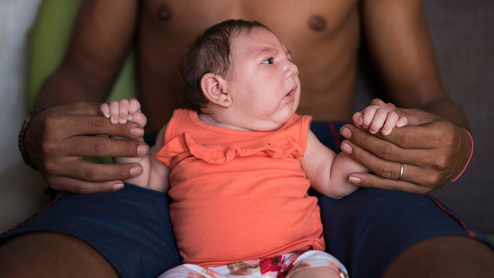 Dejailson Arruda håller sin dotter Luiza, som drabbats sedan mamman infekterats med Zika-viruset.