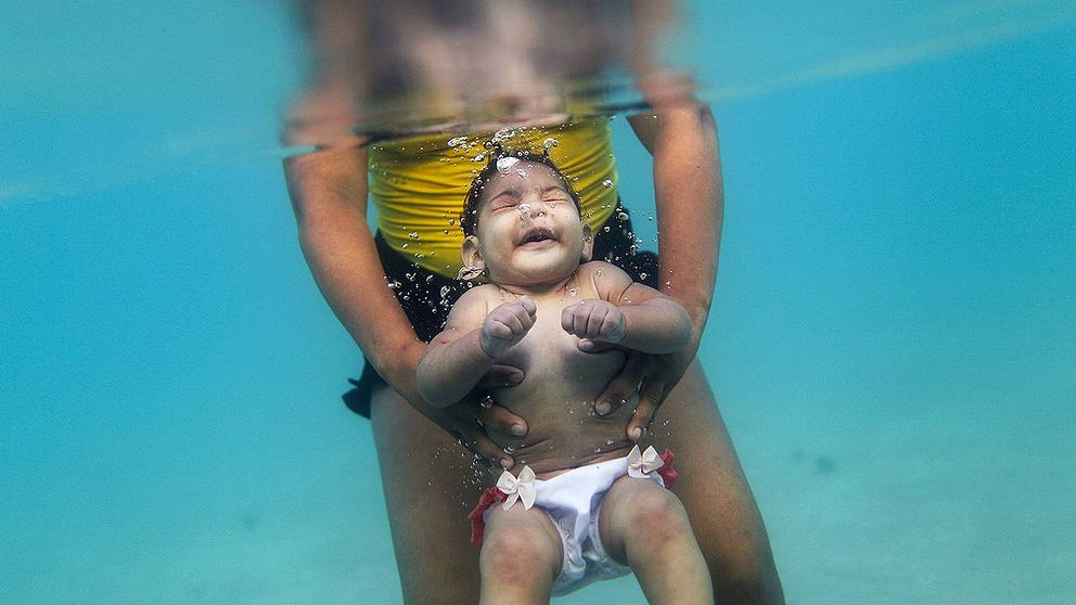 En mamma med sin fem månader gamla dotter som fötts med mikrocefali.
