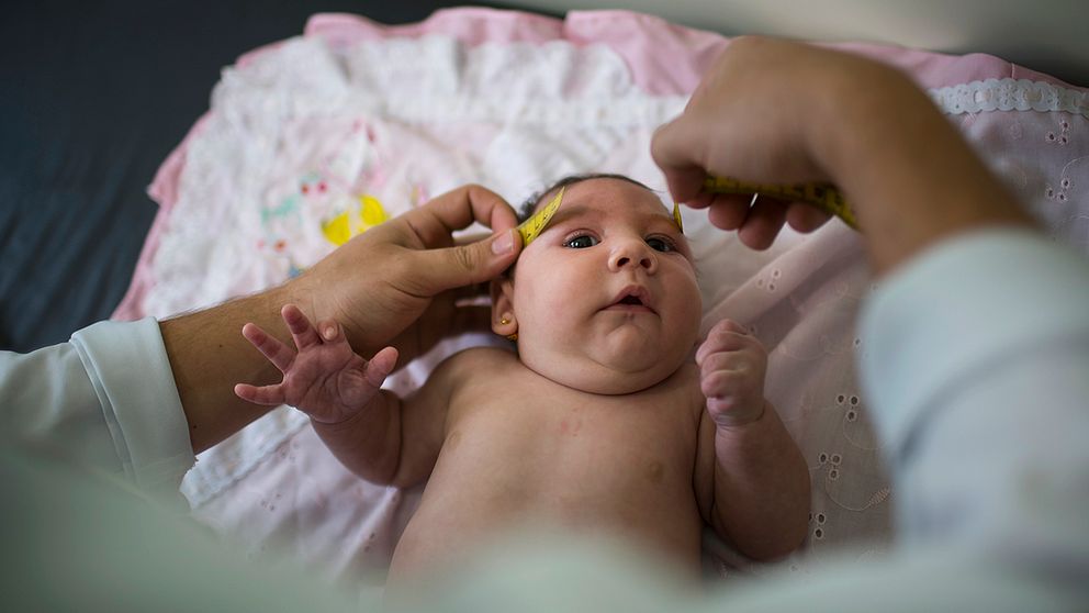 Ett spädbarn som drabbats av zika-viruset.