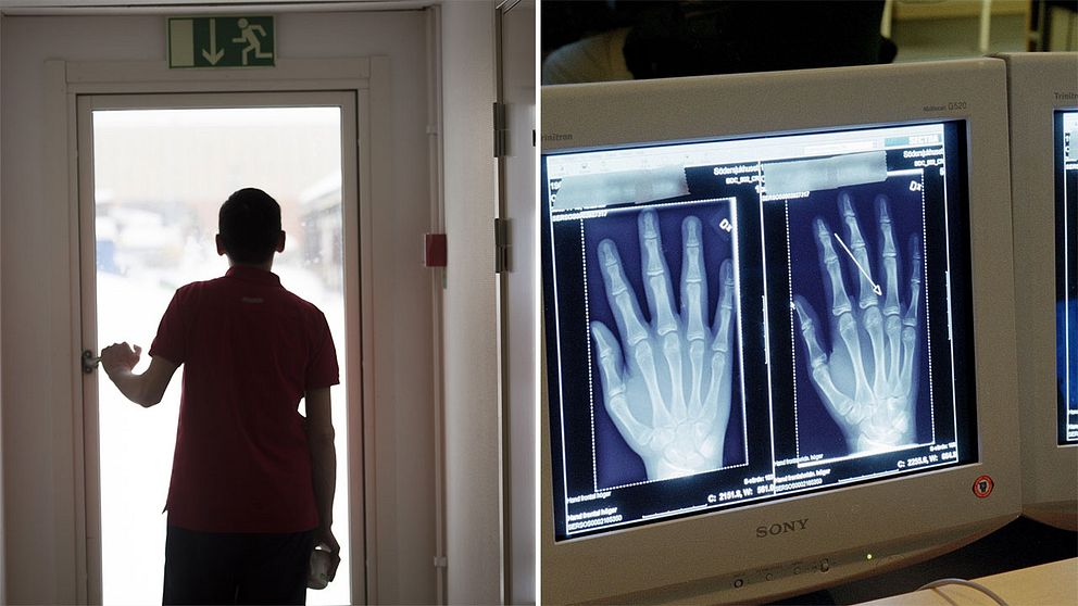 Bild på ensamkommande flyktingbarn och en dator med röntgenbilder på händer.